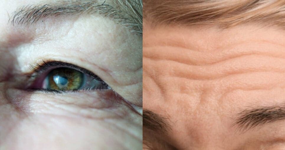 Faça antes de dormir: Único óleo natural estica pele madura das mulheres 60+