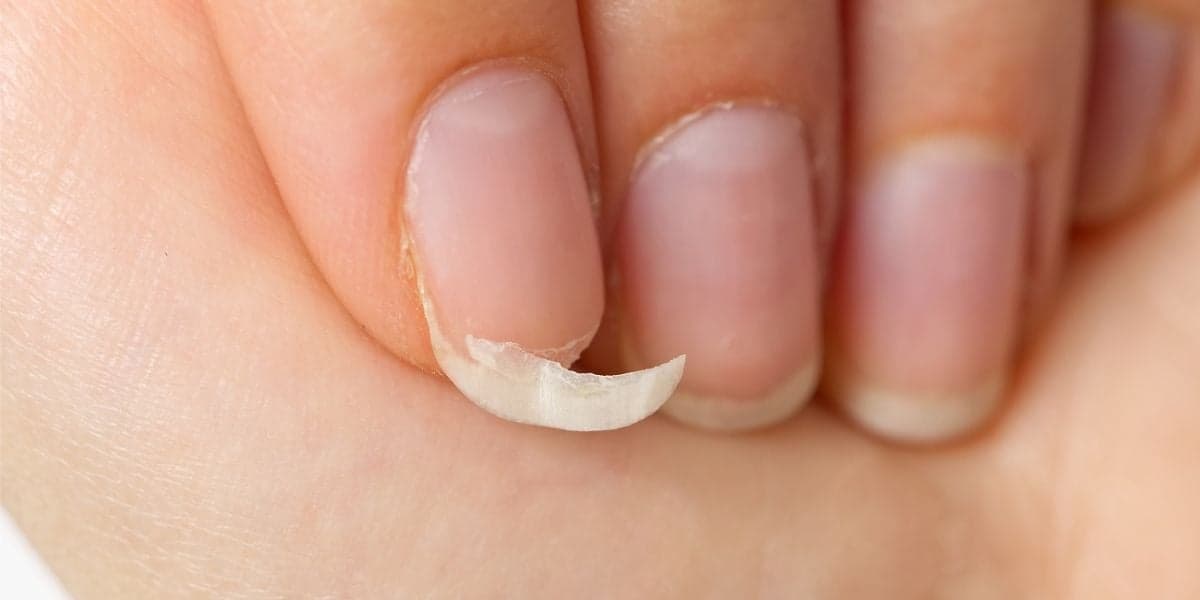 Unhas quebradas revertidas com papel higiênico (Reprodução: Divulgação) Unhas quebradas revertidas com papel higiênico (Reprodução: Divulgação)