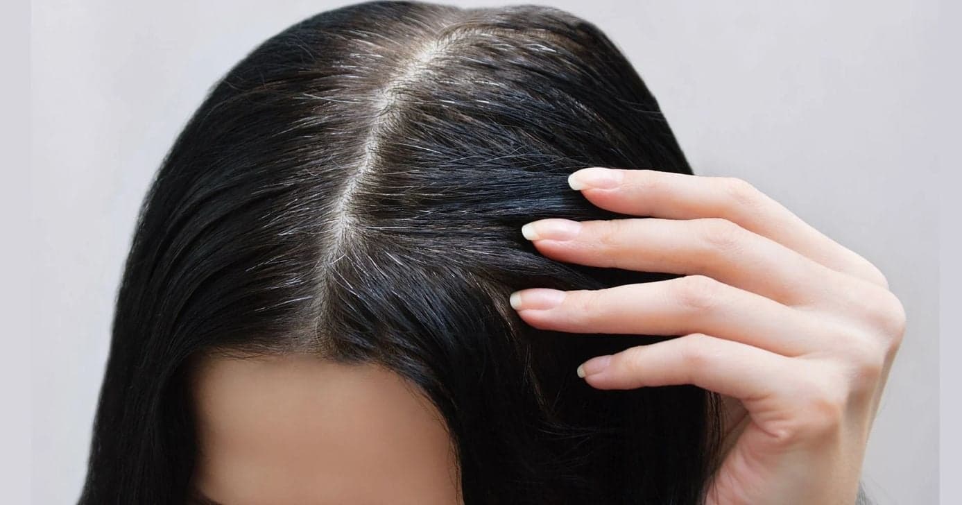 Óleo natural cobre o cabelo branco (Foto: Reprodução/ Internet)