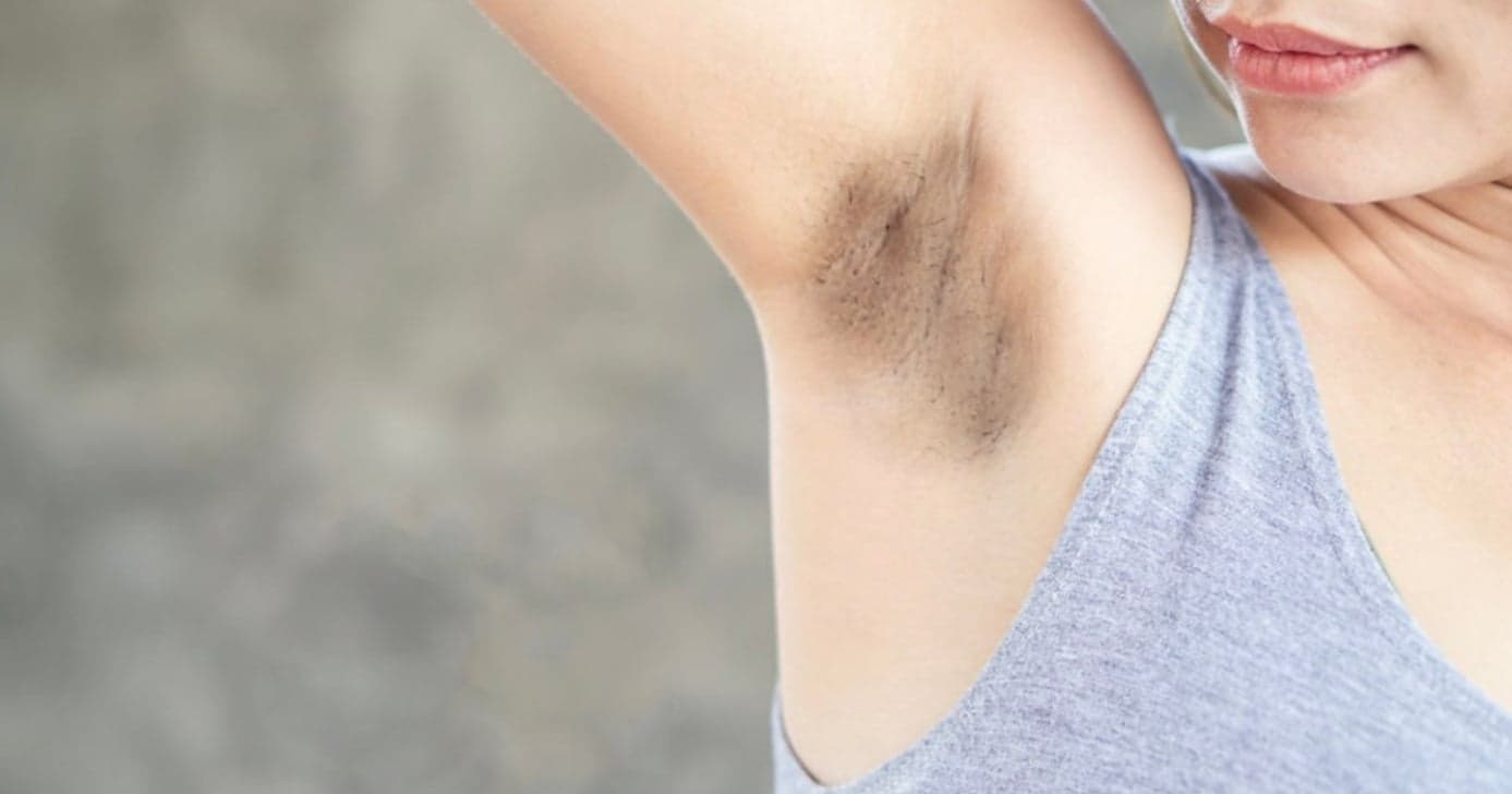 Para clarear as axilas: 5 ações de cuidado que ninguém te conta