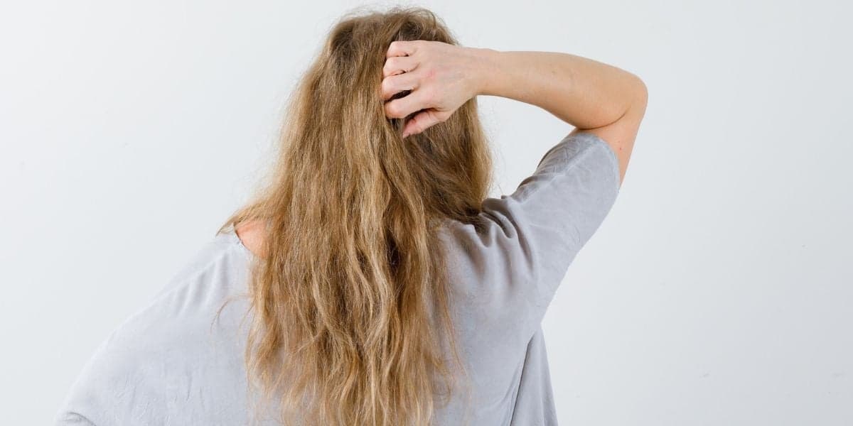 Cabelo seco causado por falta de oleosidade (Reprodução: Divulgação) Cabelo seco causado por falta de oleosidade (Reprodução: Divulgação)