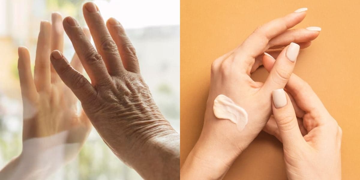 Mãos envelhecem de forma precoce e intensa: Como protegê-las e evitar surgimento de rugas