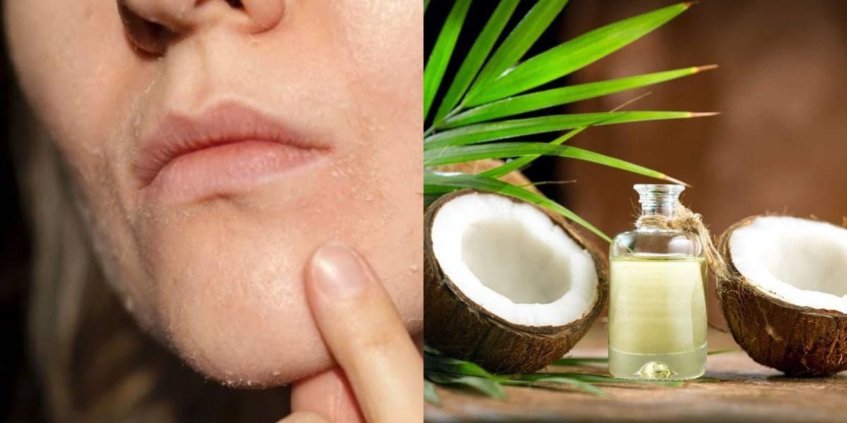 Pele opaca no inverno? Como usar o óleo de coco para manter o rosto hidratado em casa