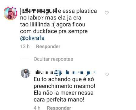 Marina Ruy Barbosa teria feito procedimento Marina Ruy Barbosa teria feito procedimento
