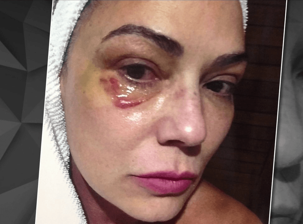 Imagem do post Imagem do post