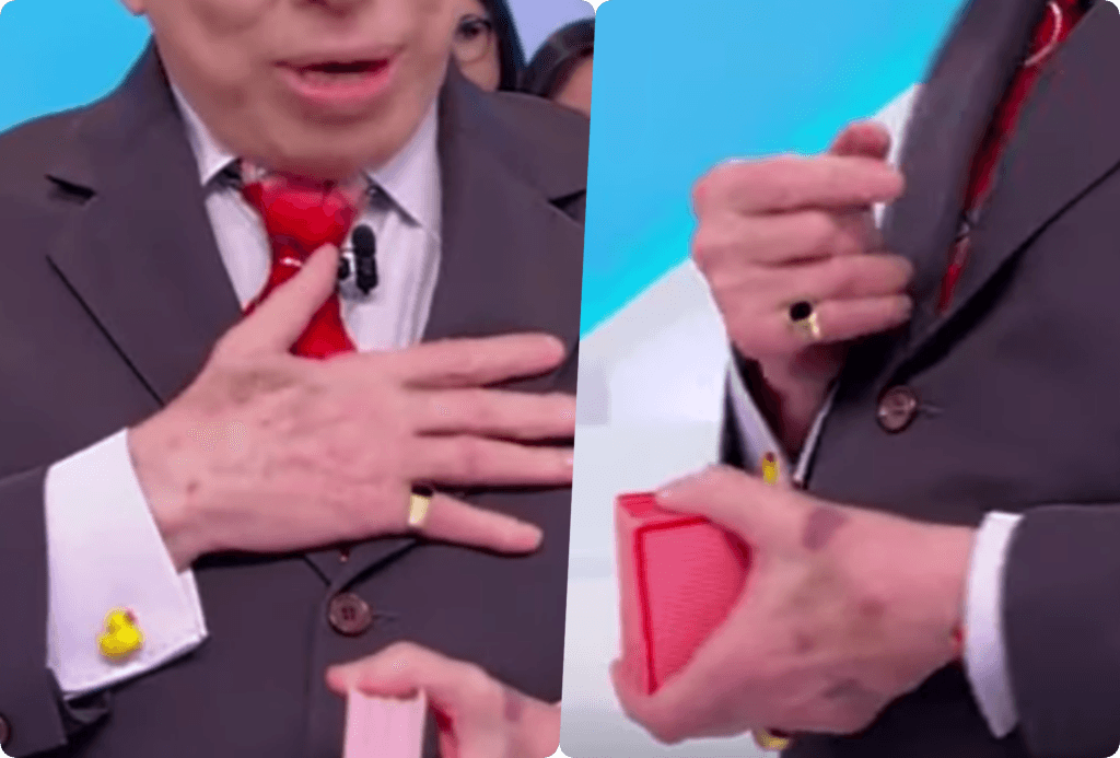Marcas roxas nas regiões das mãos de Silvio Santos estão chamando a atenção no SBT Marcas roxas nas regiões das mãos de Silvio Santos estão chamando a atenção no SBT