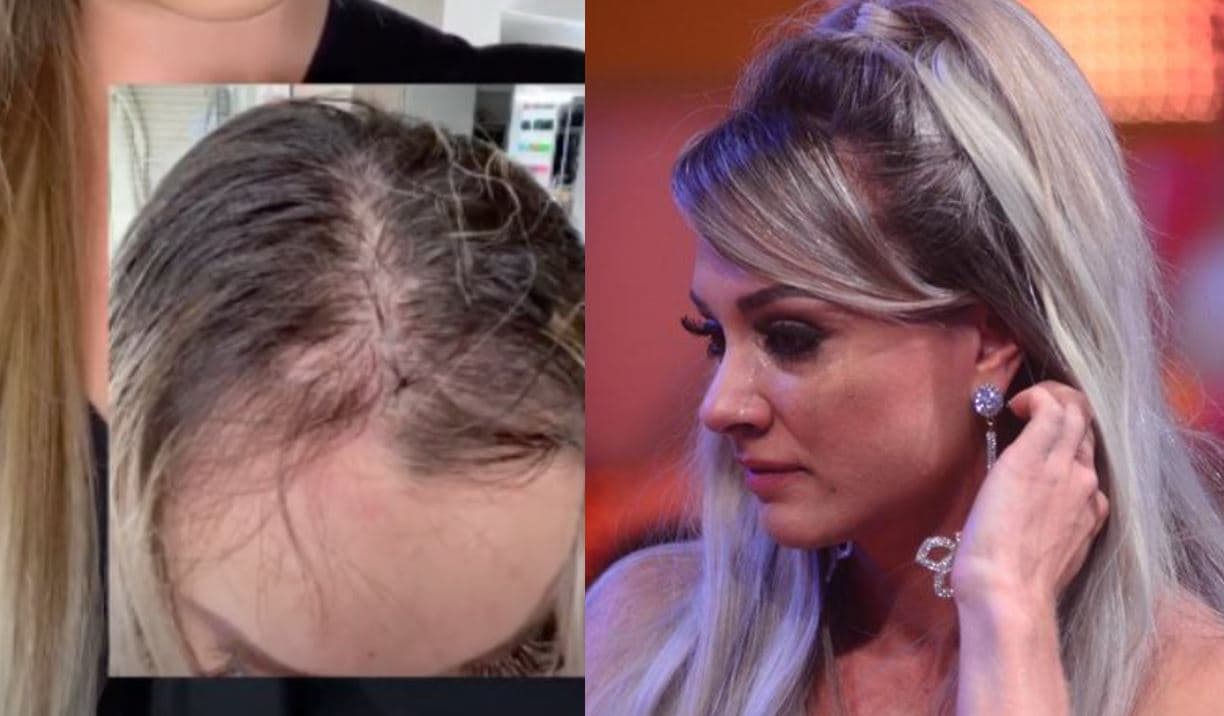 Juju Salimeni mostra queda de cabelo (Foto: Reprodução/Montagem) Juju Salimeni mostra queda de cabelo (Foto: Reprodução/Montagem)