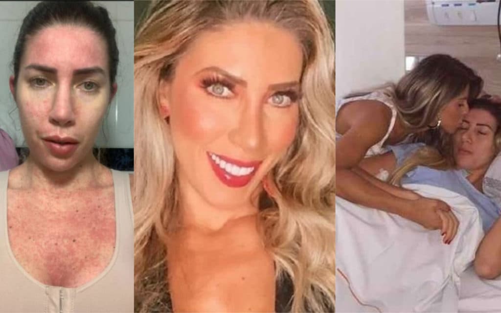 Chocante! Tati Minerato, após ser escoltada pela polícia, expõe fotos de cirurgia que quase a matou; só veja se for forte
