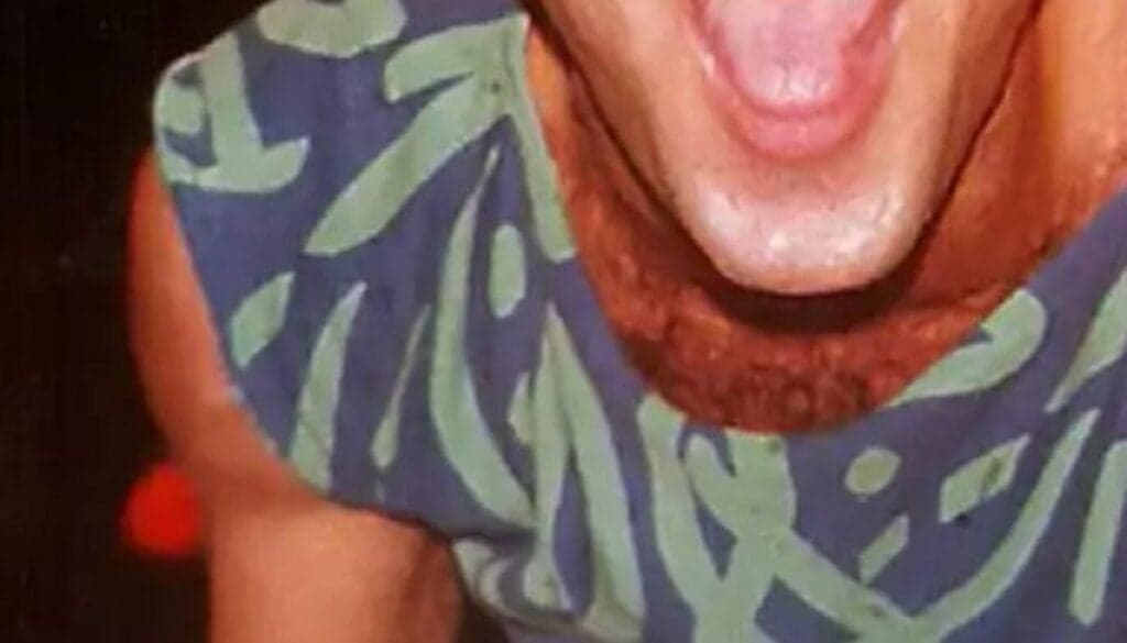 Cantor mais famoso do Brasil descobriu AIDS e última foto antes da morte expôs situação de cortar o coração