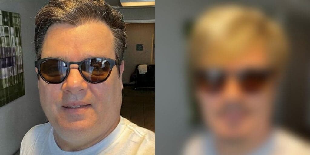 Inchado e com rosto irreconhecível, Celso Portiolli assusta com aparência e esclarece o que aconteceu