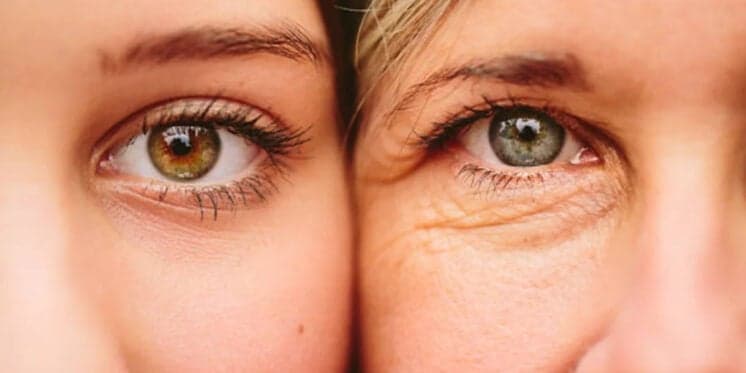 Adeus rugas: Botox natural com 4 ingredientes é um poderoso anti-idade e traz pele lisinha às 40+