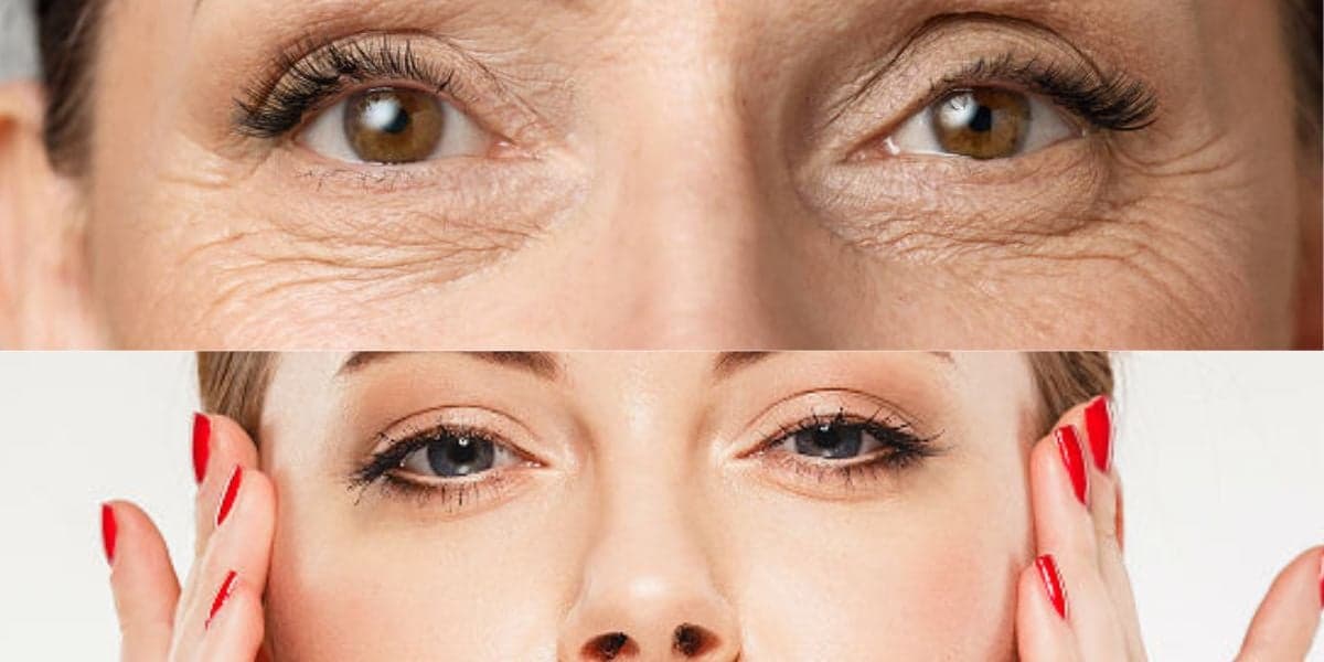 Médico confirma: 10 CREMES incríveis antirrugas rejuvenescem 20 anos em 5 dias e um sai por só R$ 50