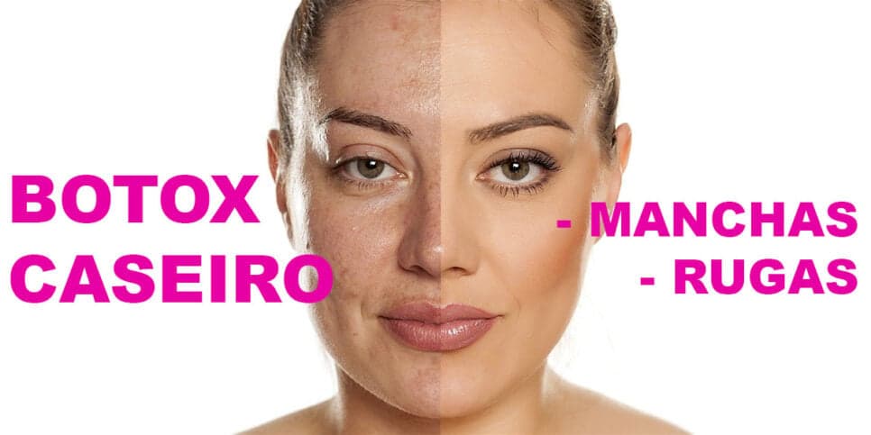 Botox caseiro - Rugas e Manchas (Foto: Reprodução - Drogaria Vera Cruz) Botox caseiro - Rugas e Manchas (Foto: Reprodução - Drogaria Vera Cruz)
