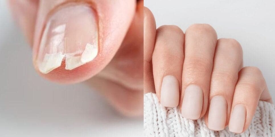 Unhas quebradas / Unhas grandes - Montagem TVFOCO Unhas quebradas / Unhas grandes - Montagem TVFOCO