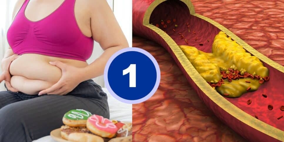 Suga a gordura do corpo: Único ingrediente previne o colesterol e idosos 60+ precisam saber disso