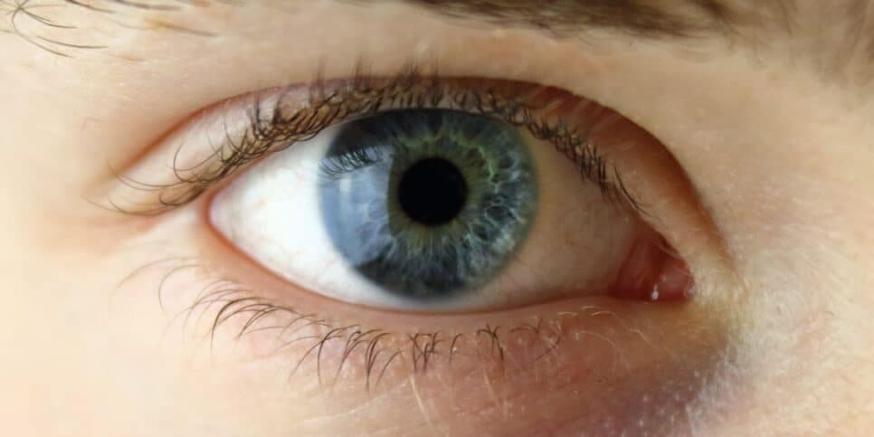 Região dos olhos sem linhas finas (Foto: Canva) Região dos olhos sem linhas finas (Foto: Canva)