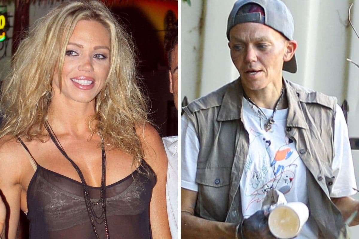 Antes e depois da ex-modelo Loni Willison (Foto: Reprodução/ Internet) Antes e depois da ex-modelo Loni Willison (Foto: Reprodução/ Internet)