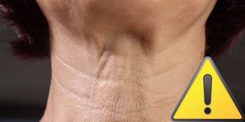 Dermatologista com 5 dicas para reduzir as rugas no pescoço (Reprodução: Montagem TV Foco) Dermatologista com 5 dicas para reduzir as rugas no pescoço (Reprodução: Montagem TV Foco)
